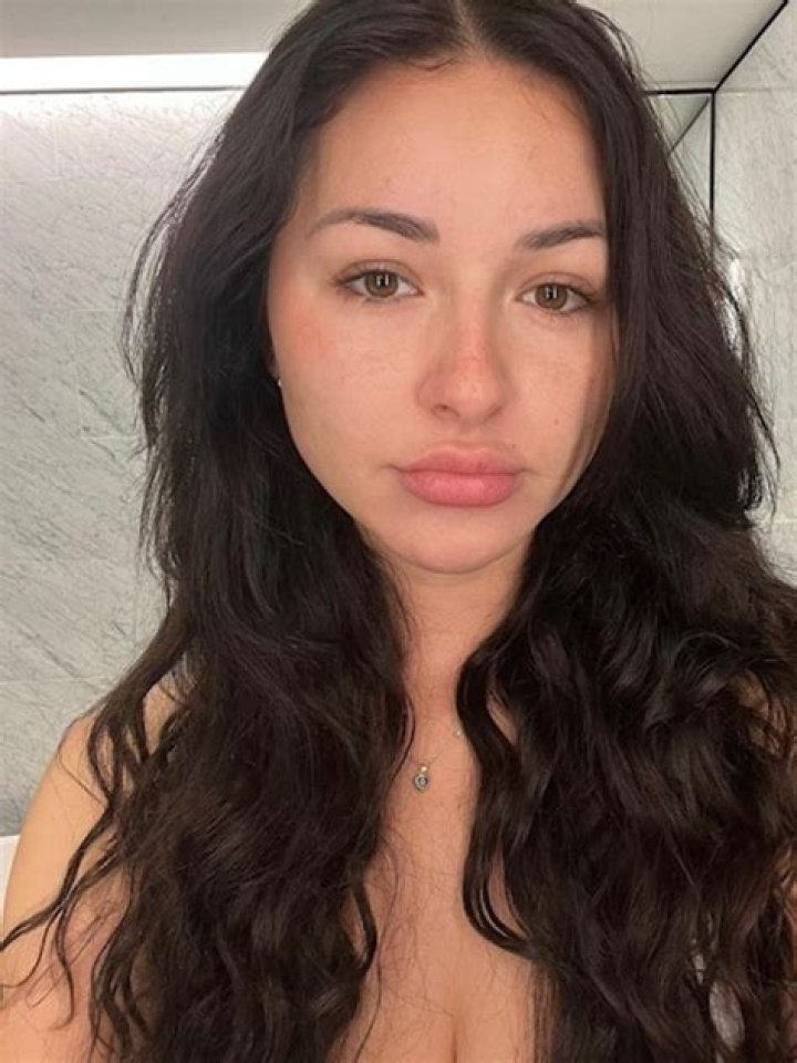 Anna Paul has revealed why she’s lost weight and had bruises