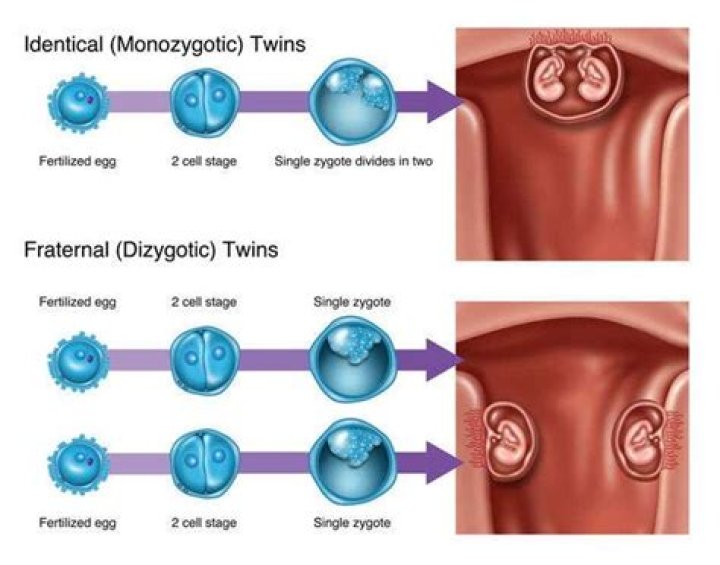 In Vitro Fertilization Gives Two Sets of Identical Twins to Couple