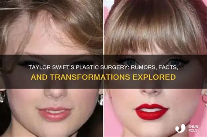 Swift's Plastic Surgery Rumors Explored