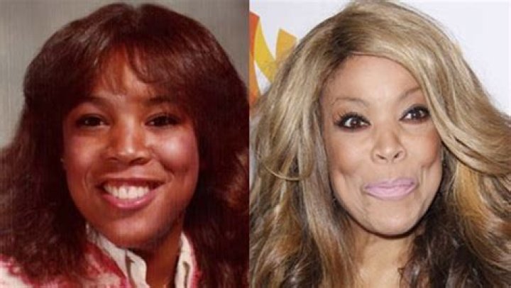Wendy Williams Before And After Plastic Surgery Photos, Did Wendy Williams Get Plastic Surgery Done?